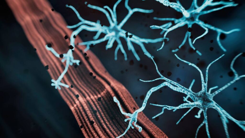 Neuromuscular Blockade